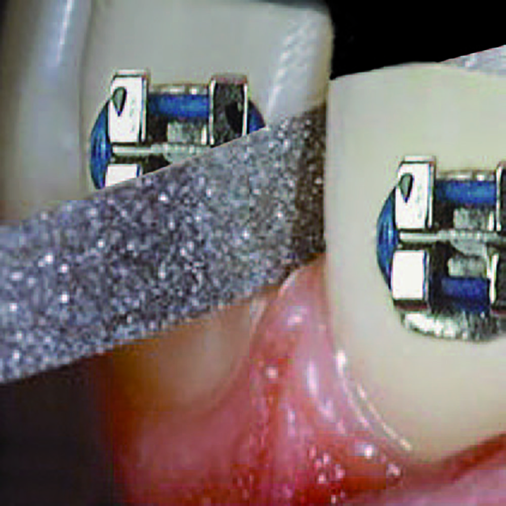 L6055.070HP Plaster Acrylic Left Hand Cross Cutter - Strauss Diamond