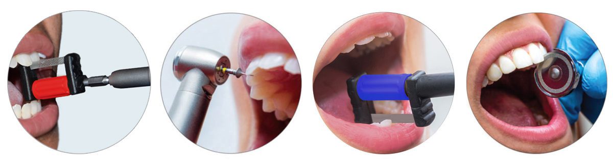 Interproximal Reduction (IPR) Dental Tools - IPR Disks, Strips, & Burs