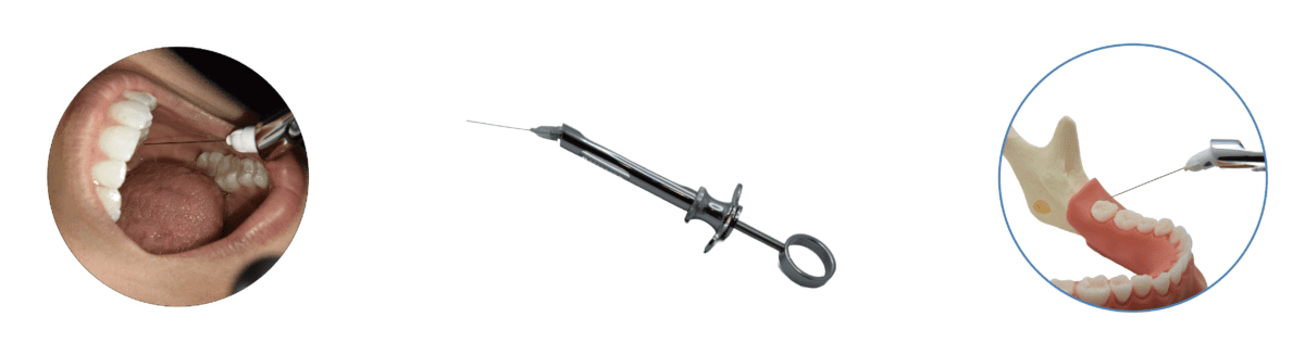 Magic Flex Syringe